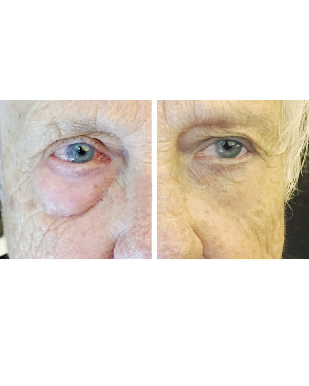 תמונה לפני ואחרי קרם פנים אנטי אייגינג